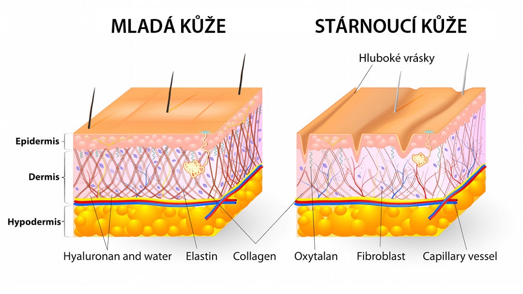 Úbytek kolagenu mladá a stárnoucí kůže